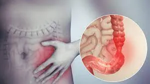 What an IBS visit looks like here